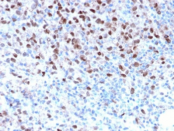 Recombinant MITF Antibody