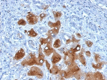 SAA Antibody / SAA1 + SAA2