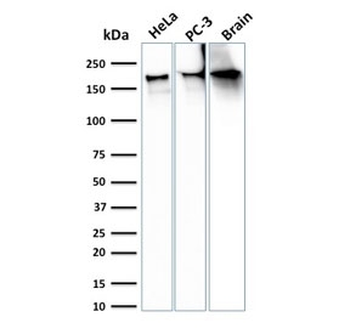 Recombinant Spectrin beta III Antibody / SPTBN2
