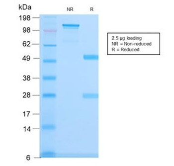 Recombinant Spectrin beta III Antibody / SPTBN2