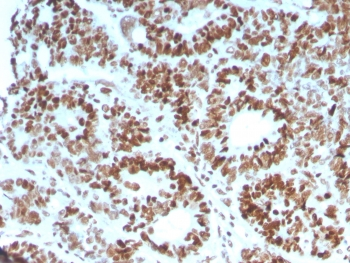MSH6 Antibody