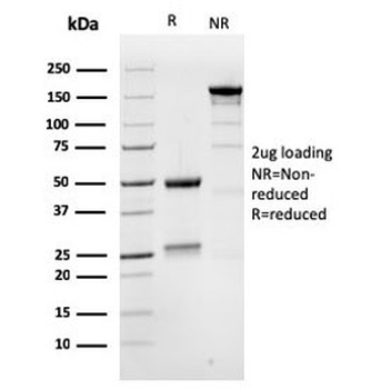 MSH6 Antibody