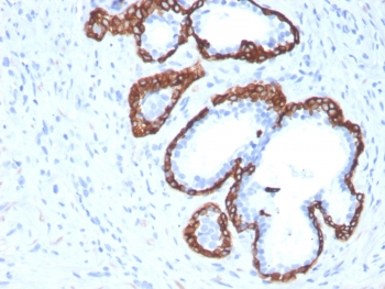 Cytokeratin 5 Antibody / KRT5 / CK5