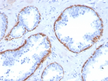 Cytokeratin 5 Antibody / KRT5 / CK5