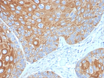 Cytokeratin 5 Antibody / KRT5 / CK5