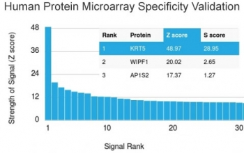 Cytokeratin 5 Antibody / KRT5 / CK5