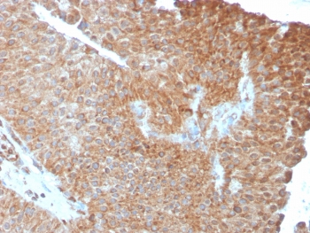 SERBP1 Antibody / PAI-RBP1