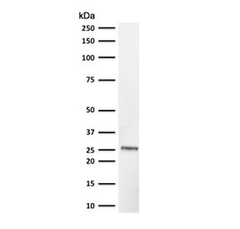 Recombinant UchL1 Antibody