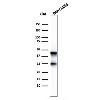 Carboxypeptidase A1 Antibody / CPA1