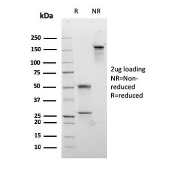 Recombinant Desmocollin 2/3 Antibody