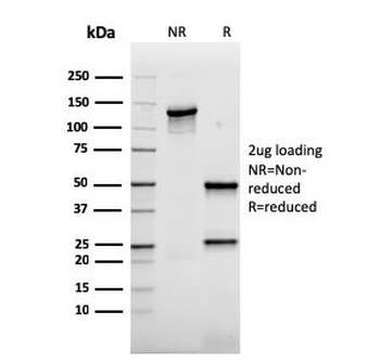 Recombinant AKT1 Antibody