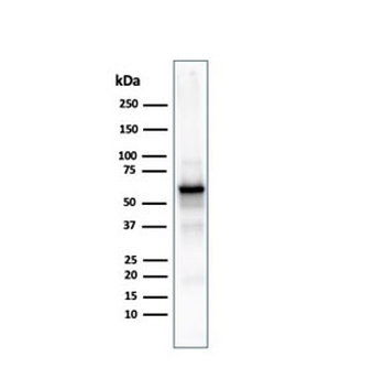 Recombinant AKT1 Antibody