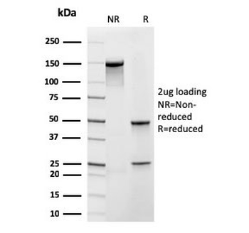 Recombinant Frataxin Antibody / FXN