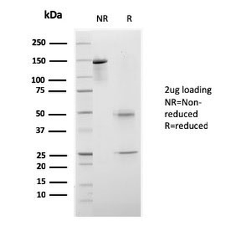 Recombinant CELA3B Antibody / Elastase 3B