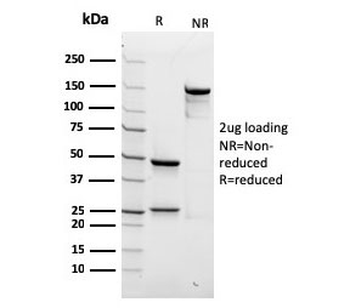 Recombinant Spectrin beta III Antibody / SPTBN2