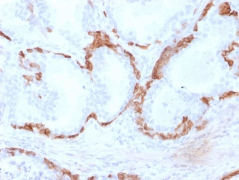Cytokeratin 14 Antibody / KRT14
