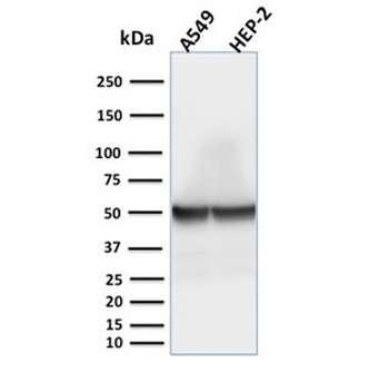 Recombinant Cytokeratin 18 Antibody