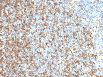 LMO2 Antibody / Rhombotin 2