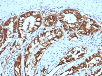 EpCAM Antibody