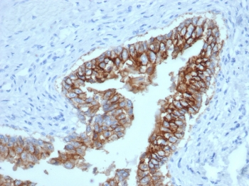 EpCAM Antibody