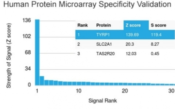 TRP1 / Tyrosinase-Related Protein-1 Antibody / TYRP1