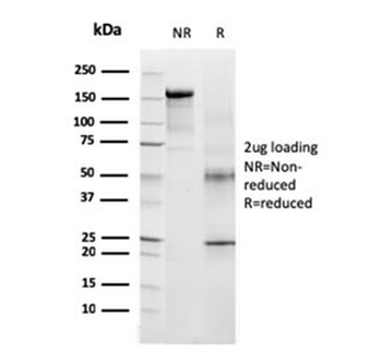 TRP1 / Tyrosinase-Related Protein-1 Antibody / TYRP1