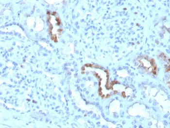 CALB1 Antibody / Calbindin