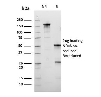CALB1 Antibody / Calbindin