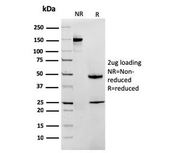 Recombinant MTAP Antibody / S-methyl-5'-thioadenosine phosphorylase