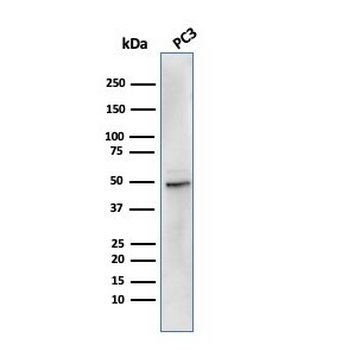 Recombinant ODC1 Antibody / Ornithine Decarboxylase