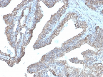 Recombinant ODC1 Antibody / Ornithine Decarboxylase