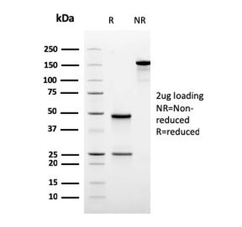 Recombinant ODC1 Antibody / Ornithine Decarboxylase