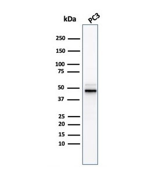 Recombinant ODC1 Antibody / Ornithine Decarboxylase