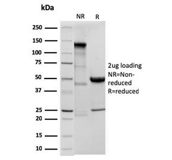 Recombinant ODC1 Antibody / Ornithine Decarboxylase