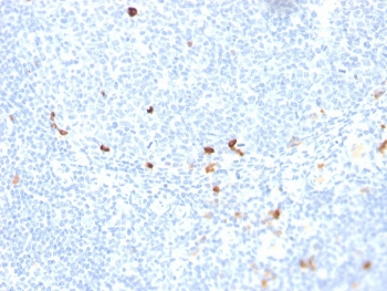 Recombinant IgM Antibody