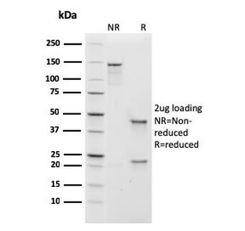 Recombinant IgM Antibody