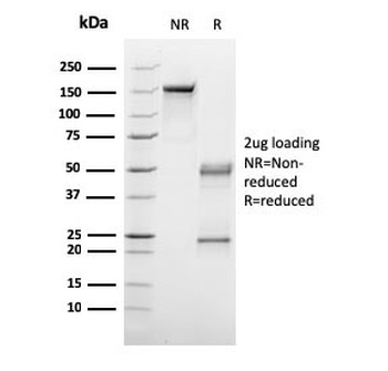 C1QA Antibody / Complement C1q A-Chain