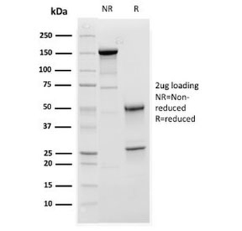 Complement C1q A-Chain Antibody / C1QA
