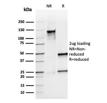 Recombinant S100A9 Antibody / MRP14 / Calgranulin B / Calprotectin