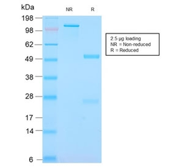 Recombinant S100A9 + Calprotectin Antibody