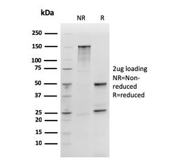 Recombinant SOX2 Antibody