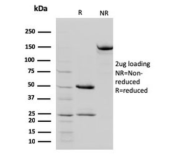 STAT5b Antibody