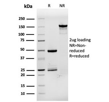 Recombinant pS2 Antibody / TFF1