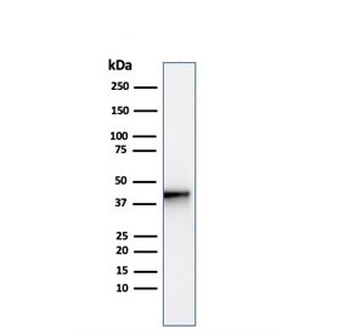 Recombinant AMACR Antibody / p504S