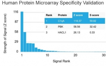 C1QA Antibody / Complement C1q A-Chain