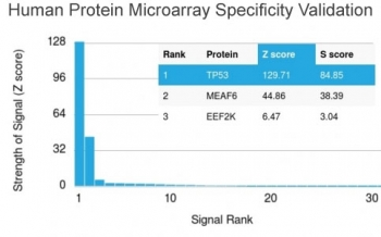 p53 Antibody / TP53