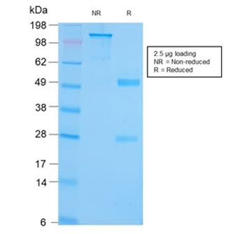 Recombinant GRP94 Antibody / HSP90B1