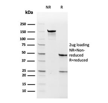 Recombinant Thymidylate Synthase Antibody