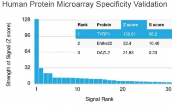 Tyrosinase-Related Protein-1 Antibody / TRP1 / TYRP1