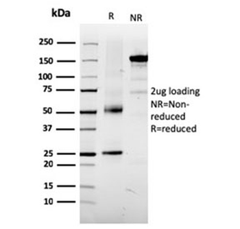 Tyrosinase-Related Protein-1 Antibody / TRP1 / TYRP1